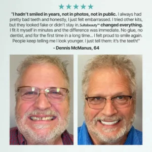 Ends Today: 70% OFF! Sultabeauty™? Custom-Fit Full Functional DenturesMake you more confident